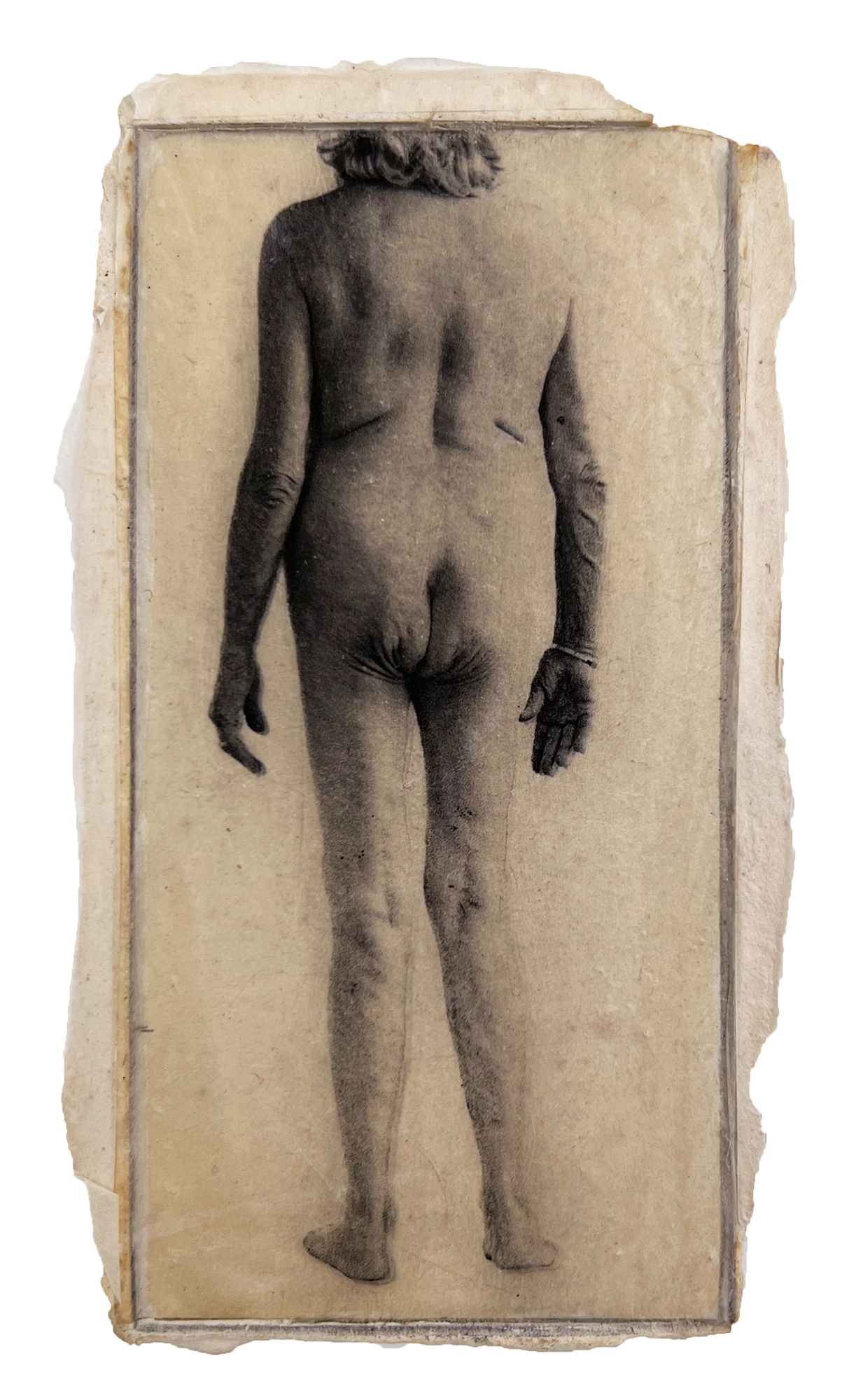 A photo print on special paper printed on plaster shows an elderly woman, standing, nude from neck to toe and seen from the rear, with sagging skin, and veins showing through arms and legs.